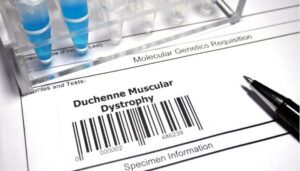 Duchenne - Distrofia Muscular - Elevidys