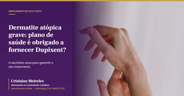 Dermatite atópica grave: plano de saúde é obrigado a fornecer Dupixent?