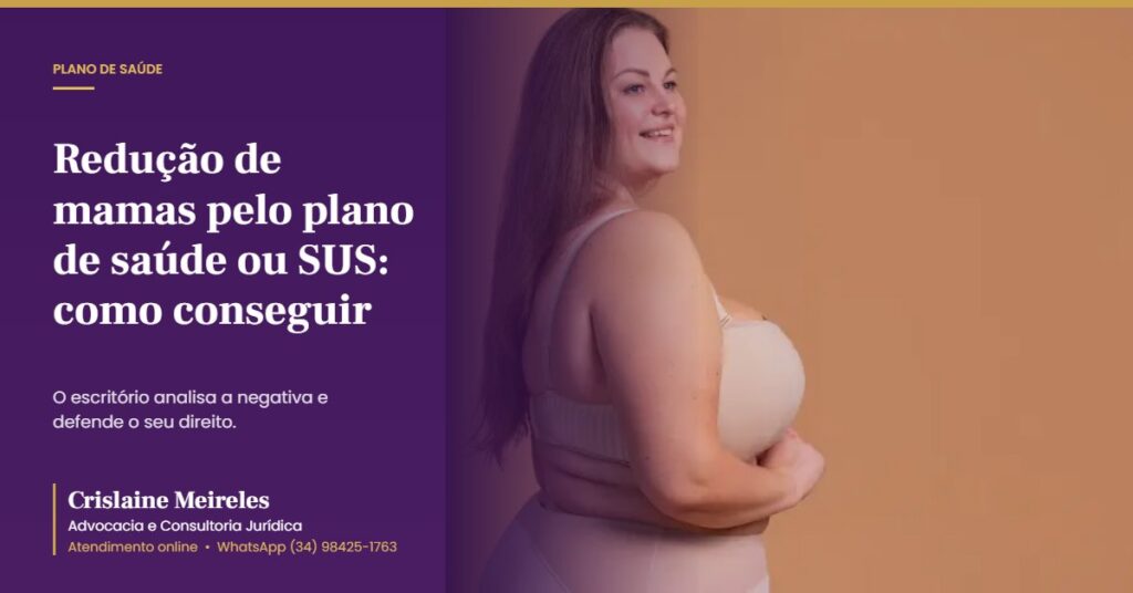 Redução de mamas pelo plano de saúde ou SUS: como conseguir