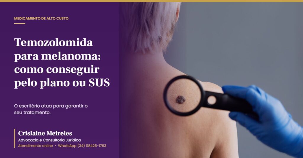 Temozolomida para melanoma: como conseguir pelo plano ou SUS