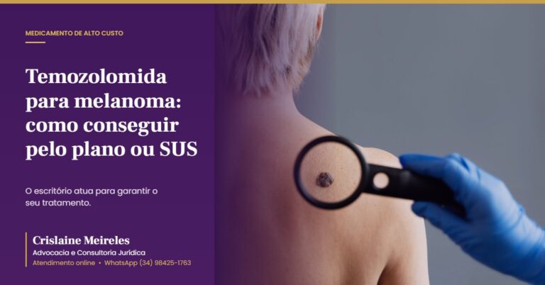 Temozolomida para melanoma: como conseguir pelo plano ou SUS